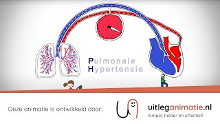 Uitleganimatie  VUmc Pulmonale Hypertensie [upl. by Madeline]