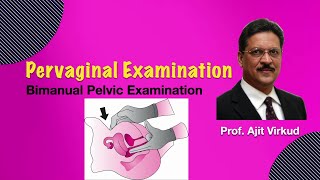 Bimanual PV Examination [upl. by Analad]