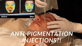 Injections for Dark Pigmentation  Seoul Guide Medical [upl. by Sherburn]