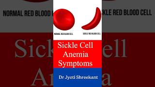 Sickle cell anemia symptoms shorts ytshorts [upl. by Finella]