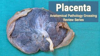 Placenta  Anatomical Pathology Grossing Review Series [upl. by Eanat]