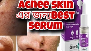 Acne skin এর জন্য Best Serum  acne problem solve dark spot reduction skin repair serum skincare [upl. by Aubin633]