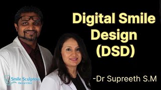 Digital Smile Design  DSD  By Dr Supreeth SM [upl. by Holbrook]