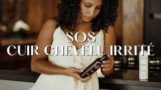 COMMENT SOIGNER SON CUIR CHEVELU IRRITÉ [upl. by Alejandrina848]