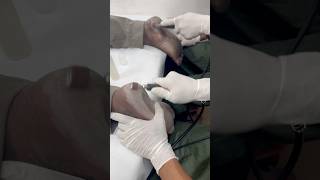 footcare footreflexology shorts trending beauty short youtubeshorts skincaretips link 👇🏽 [upl. by Ahtivak]