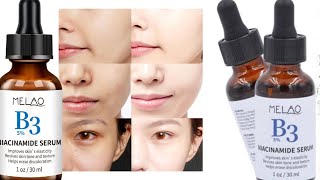 Melao B3 5 Niacinamide Serum Review in Bangla একটি সিরাম ব্যাবহার করে মুখের সব কালো দাগ দূর করুণ [upl. by Drescher]