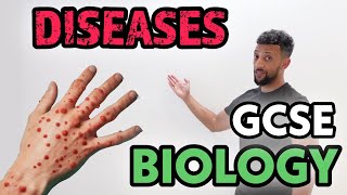 GCSE Biology  Infectious Diseases Rap [upl. by Iva]