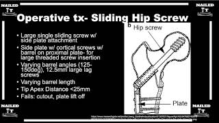 Dynamic Sliding Hip Screw Device Explained Clearly w Dr Sanders [upl. by Mcdougall156]