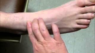 Sample Video  Palpate for Dorsalis Pedis Pulse [upl. by Wj891]