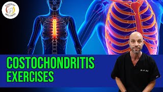 Costochondritis Exercises [upl. by Bear]