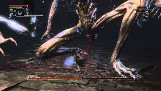 Bloodborne  HOW TO Kill Amygdala Super EasyDefiled Chalice [upl. by Leirraj761]