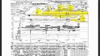 Understanding Clinical Waveforms recorded with the MB Jr  2 of 2avi [upl. by Ennairam95]