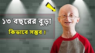 Sam Berns  ১৩ বছরের বুড়া  Life Story Of Sam Berns [upl. by Eiramave]