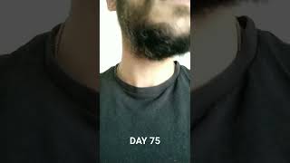 Patchy beard 75 days growth 32 yo 2024 [upl. by Lebyram779]