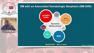 Diagnosis and management of systemic mastocytosis whats new in 2024 [upl. by Brag]