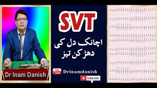 SVT In Urdu amp Hindi supraventricular SVT SupraventriculartachycardiaSVT heartbeat [upl. by Artinak]