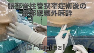 腰部脊柱管狭窄症術後の腰部硬膜外麻酔 epidural anesthesia by DrEpiCal [upl. by Berkeley]