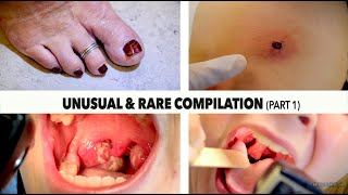 UNUSUAL or RARE DIAGNOSIS COMPILATION Part 1  Dr Paul [upl. by Atinel353]