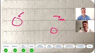 EKG befunden Echtes EKGFallbeispiel mit ärztlicher Auswertung  Kommst du auf die Diagnose [upl. by Htederem743]