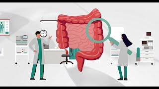 Colorectal Cancer Screening Fecal Immunochemical Test FIT  OCSENSOR [upl. by Ronacin]