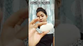 Acnestar Gel and Soap  Remove pimples Acnestar shorts ytshorts skincare acne [upl. by Eldridge764]