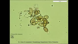 Clonorchis sinensis Eggs [upl. by Llemar]