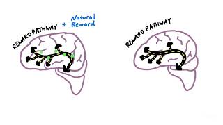 How an Addicted Brain Works [upl. by Irbua882]