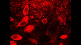 Parasitic Schistosoma haematobium eggs visualized in the bladder by 2photon microscopy [upl. by Skiest]