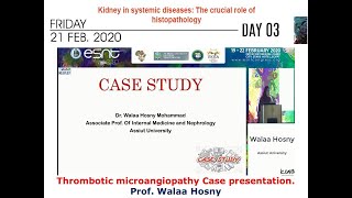 Thrombotic microangiopathy Case presentation prof Walaa Hosny [upl. by Clayton]