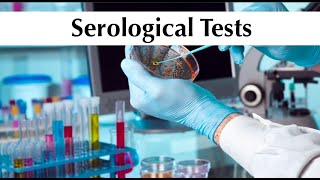 Microbiology 5th practical tuotorial quotSerological Testsquot by ASM Minds Team [upl. by Zink]