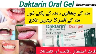 How to use Daktarin oral gel  uses in Urdu [upl. by Watt]