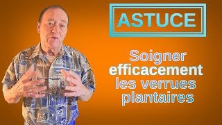 ASTUCE  Extraire EFFICACEMENT une verrue plantaire [upl. by Nytsirk]