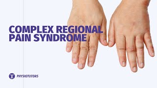 Complex Regional Pain Syndrome  CRPS  Wrist amp Hand [upl. by Lyrret]