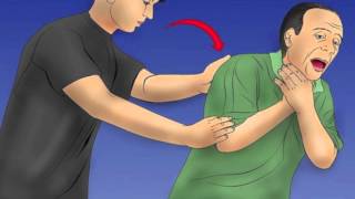 How to do the Heimlich Maneuver [upl. by Nohtiek]