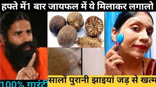 कितनी भी पुरानी झाइयां Pigmentation जड़ से खत्म करो How To Remove Pigmentation [upl. by Alyam]