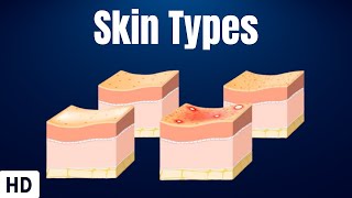 Skin Types Everything You Need To Know [upl. by Enogitna773]