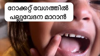 toothache 😬പല്ലുവേദന വന്നാൽ വീട്ടിൽ ചെയ്യാൻ പറ്റുന്ന ടിപ്സ്  video homeremedy  viral  tooth [upl. by Eniala]