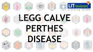 Legg Calve Perthes Disease [upl. by Amilah]