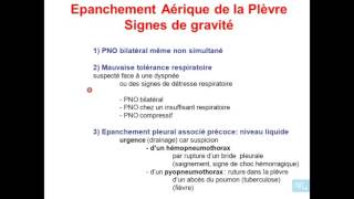 Les Grandes syndromes pulmonaires Partie 5 [upl. by Dunston]