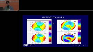 AIOC2018  GP035  Topic  Pentacam Scheimpflug – A Sophisticated Imaging  DrShreyas Ramamurthy [upl. by Aenert538]