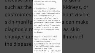 Systemic Sclerosis sine Scleroderma rheumatology scleroderma sclerosis [upl. by Valry]