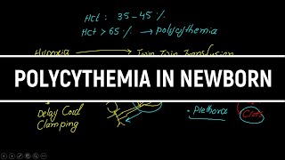 Polycythemia In Newborn Causes Presentation Investigations Treatment in HindiUrdu [upl. by Nho]