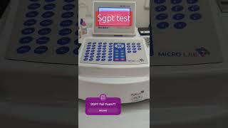 SGPT TEST ALT TEST VIRAL VIDEO TRENDING Yt INDIA SHORTS PATHOLOGY LIVER JOIN US LAB TEST [upl. by Thurlow]