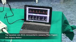 Tip Location con ECG intracavitario sistema PilotVygon PiccPort dott D Merlicco [upl. by Eelytsirk977]