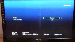 Amiko Mini Combo Receiver  Tune in Saorview Channels [upl. by Lledo]