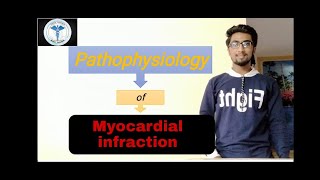 Pathophysiology of Myocardial Infraction  Hindi Explanation  Simple pathophysiology of MI [upl. by Elletnahc701]