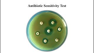 Antibiotic Sensitivity Test [upl. by Skell4]