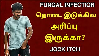 தொடை இடுக்கில் அரிப்பு இருக்கா  Fungal infections  Jock itch  Causes  Prevention  Tamil  MM [upl. by Adalai689]