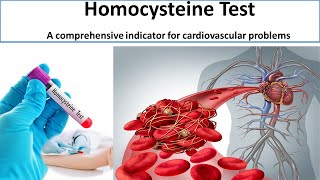 Homocysteine Test A comprehensive indicator for cardiovascular problems [upl. by Nosae]