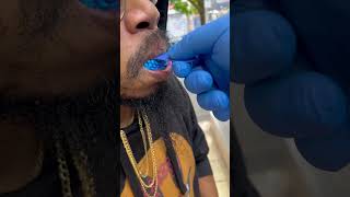 Custom Moissanite or lab diamond grillz in NYC [upl. by Anyat415]